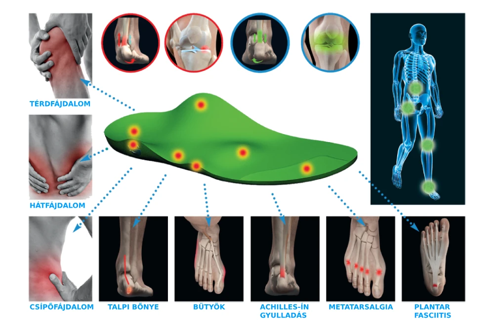 A művégtag ellátás folyamata