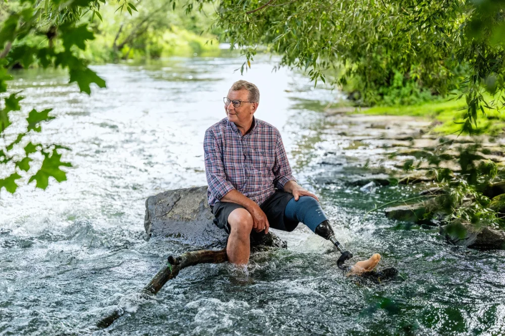 Mitől modernek a modern művégtagok?