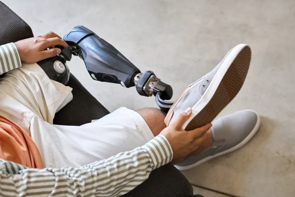 4 kérdés a láb protézis viseléséről